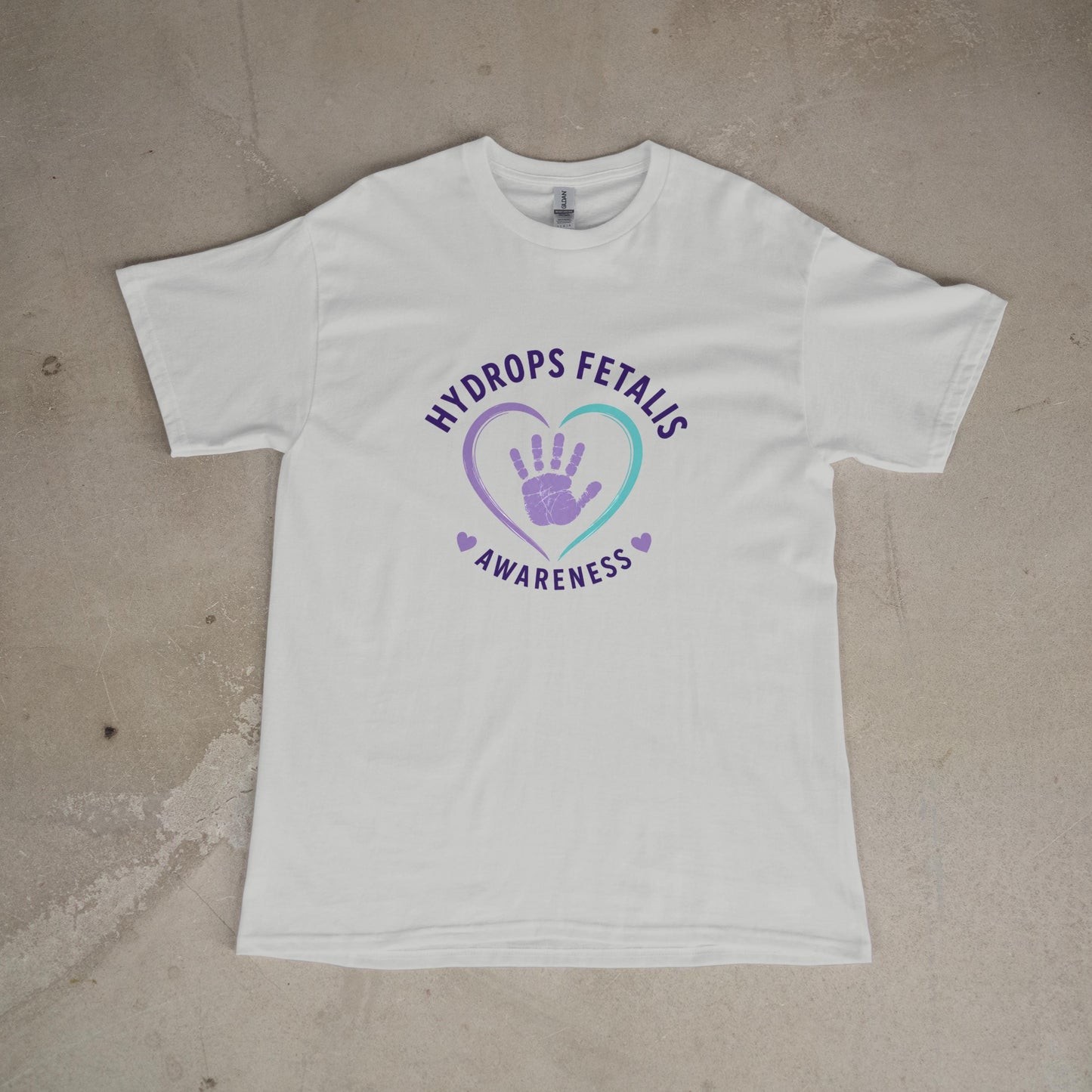Hydrops Fetalis Awareness T-Shirt – Baby Loss Support NICU Warrior Tee