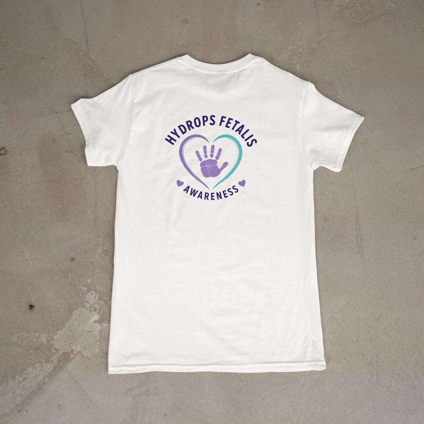 Hydrops Fetalis Awareness T-Shirt – Baby Loss Support NICU Warrior Tee